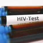 hiv-test