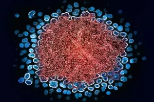 hiv