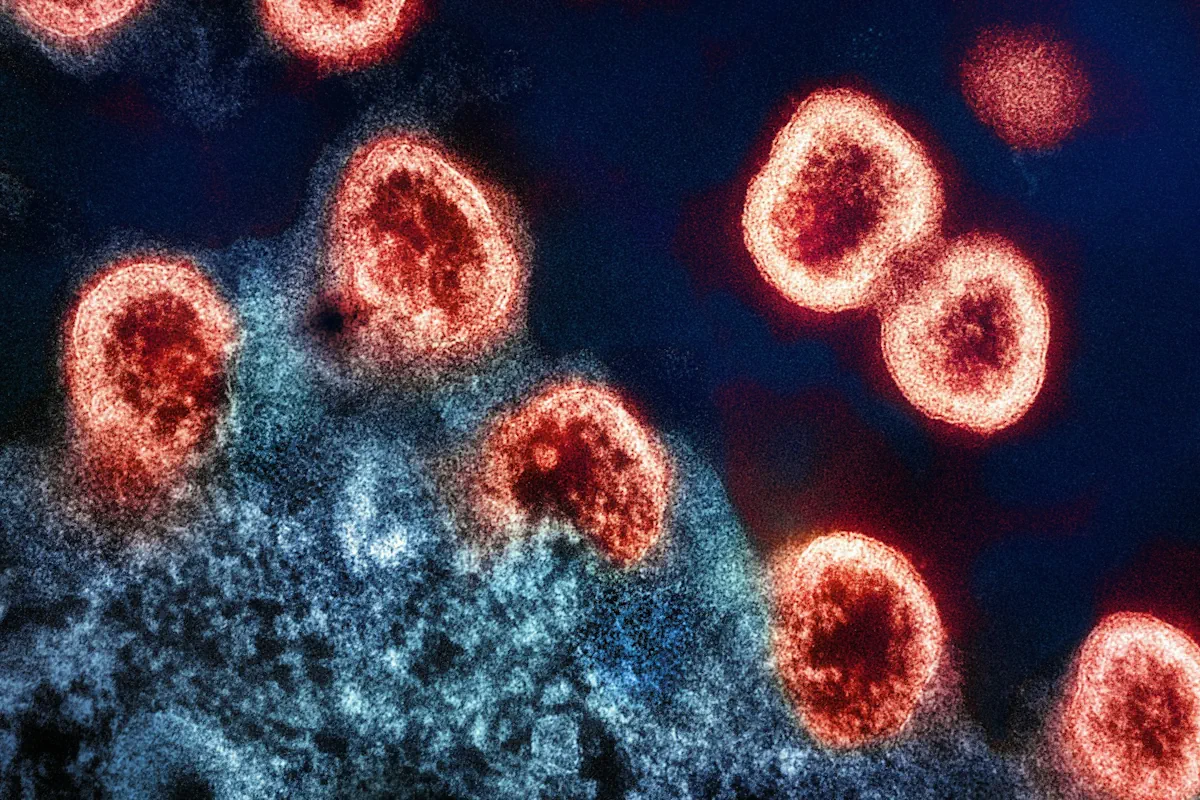 hiv-virus-ursprung