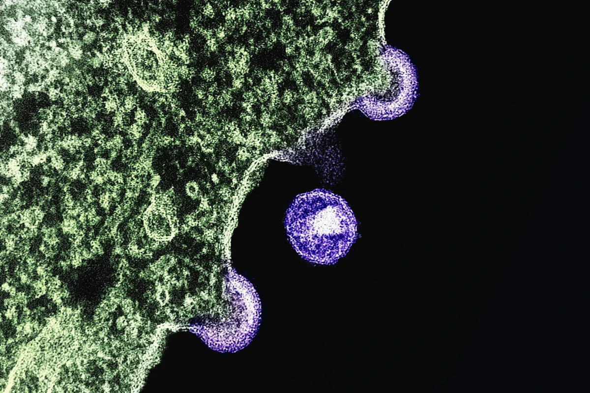 hiv-virus