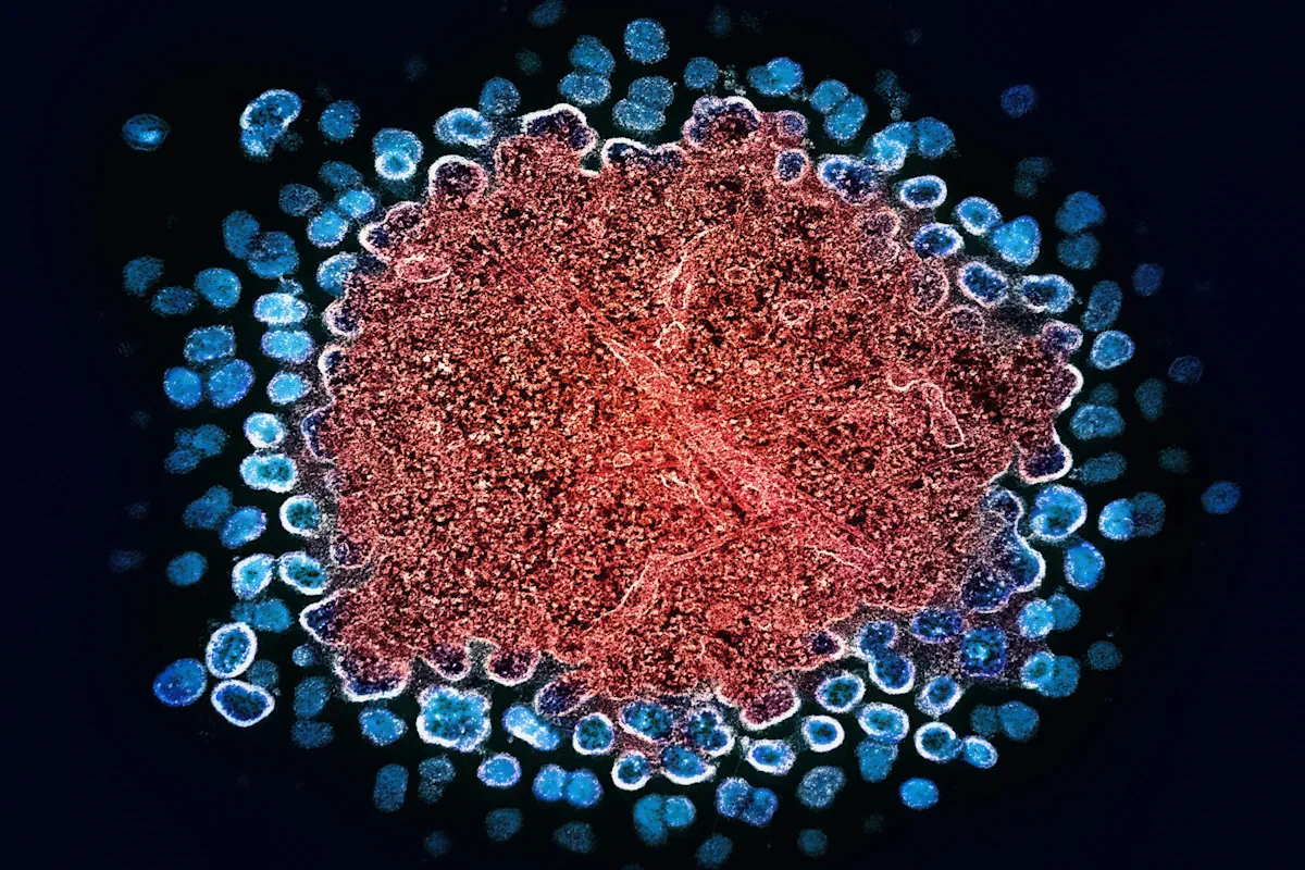 hiv